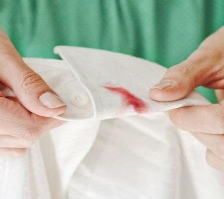 7 trucos para eliminar manchas de sangre en la ropa